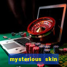 mysterious skin online dublado